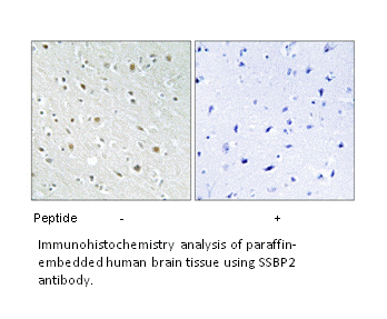 Product image for SSBP2 Antibody