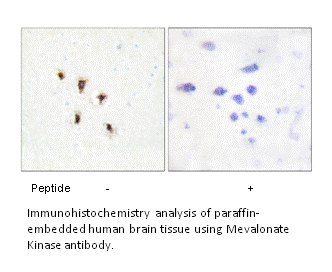 Product image for Mevalonate Kinase Antibody