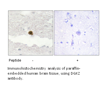 Product image for DGKZ Antibody