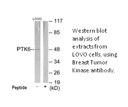 Product image for Breast Tumor Kinase Antibody