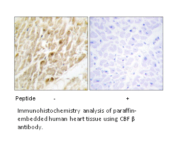 Product image for CBF &beta; Antibody