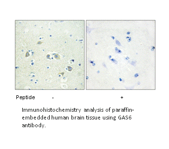 Product image for GAS6 Antibody