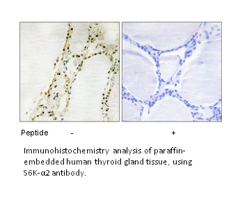 Product image for S6K-&alpha;2 Antibody