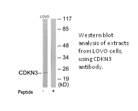 Product image for CDKN3 Antibody