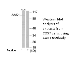 Product image for AAK1 Antibody