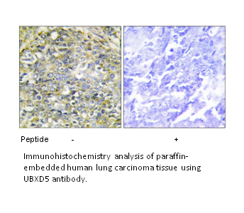 Product image for UBXD5 Antibody