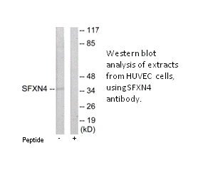 Product image for SFXN4 Antibody