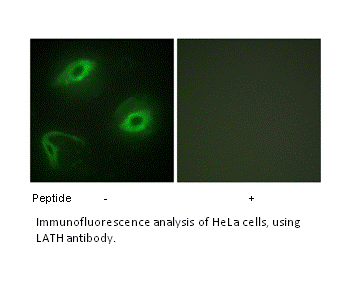 Product image for LATH Antibody