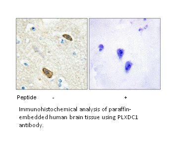 Product image for PLXDC1 Antibody