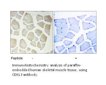 Product image for CDKL3 Antibody