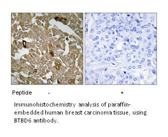 Product image for BTBD6 Antibody