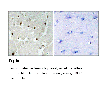 Product image for TREF1 Antibody