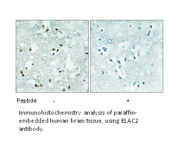 Product image for ELAC2 Antibody