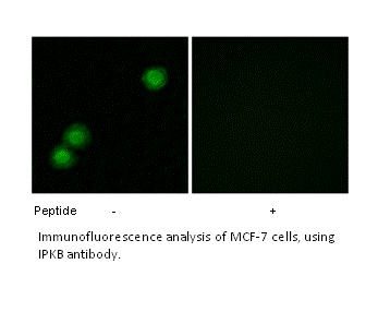 Product image for IPKB Antibody