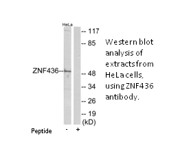 Product image for ZNF436 Antibody