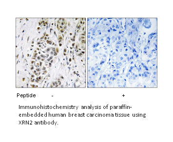 Product image for XRN2 Antibody