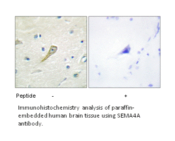 Product image for SEMA4A Antibody