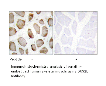 Product image for DUS2L Antibody