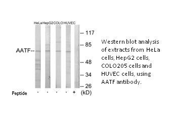 Product image for AATF Antibody