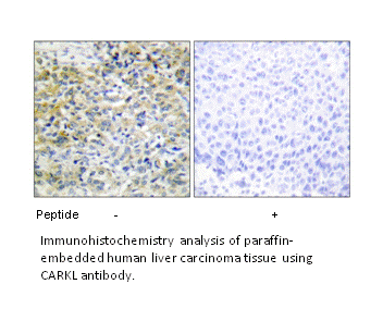 Product image for CARKL Antibody