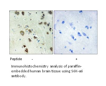 Product image for S6K-&alpha;6 Antibody