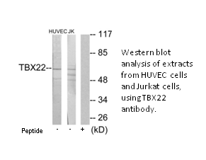 Product image for TBX22 Antibody