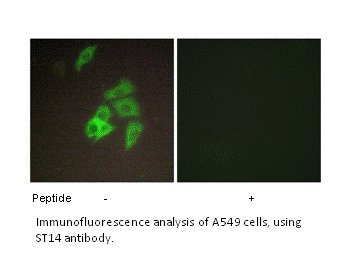 Product image for ST14 Antibody