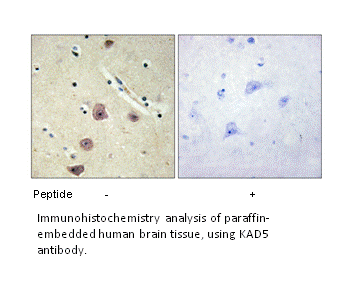 Product image for KAD5 Antibody