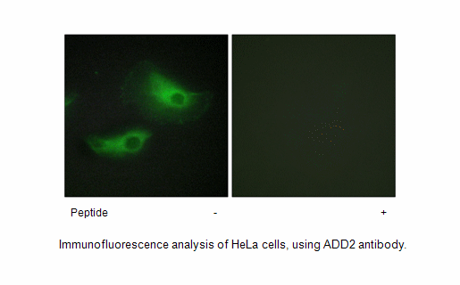 Product image for ADD2 Antibody