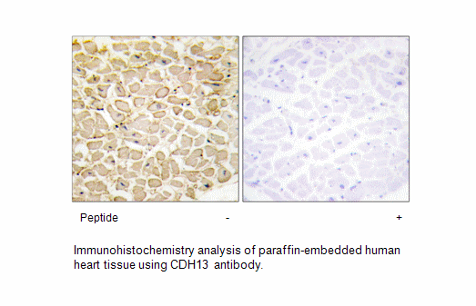 Product image for CDH13 Antibody