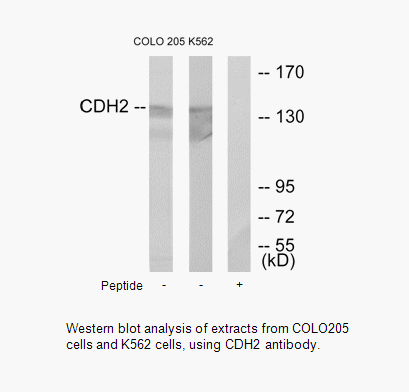 Product image for CDH2 Antibody