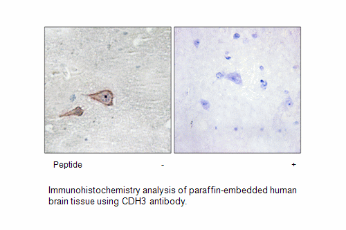 Product image for CDH3 Antibody