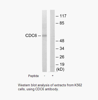 Product image for CDC6 Antibody