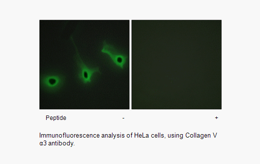 Product image for Collagen V &alpha;3 Antibody