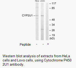 Product image for Cytochrome P450 2U1 Antibody