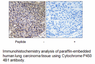 Product image for Cytochrome P450 4B1 Antibody