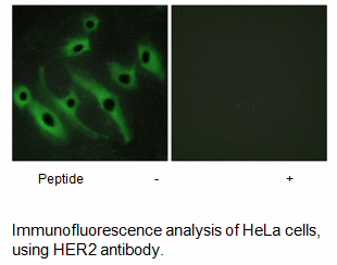 Product image for HER2 Antibody