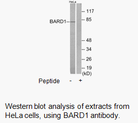 Product image for BARD1 Antibody