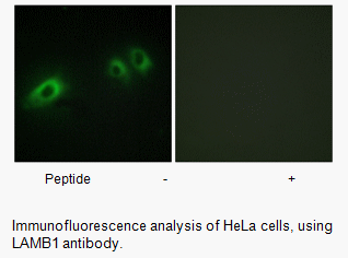 Product image for LAMB1 Antibody