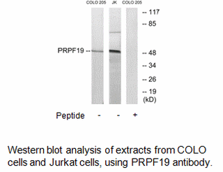 Product image for PRPF19 Antibody