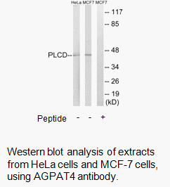 Product image for AGPAT4 Antibody