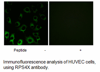 Product image for RPS4X Antibody