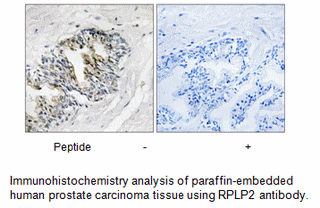 Product image for RPLP2 Antibody