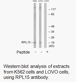 Product image for RPL15 Antibody