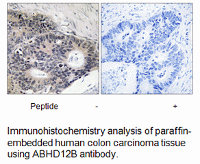 Product image for ABHD12B Antibody