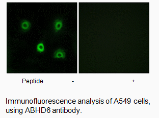 Product image for ABHD6 Antibody