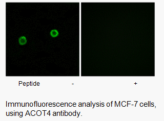 Product image for ACOT4 Antibody