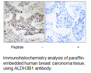 Product image for ALDH3B1 Antibody