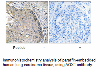 Product image for AOX1 Antibody