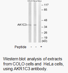 Product image for AKR1C3 Antibody